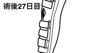 半月板入院日記 #29 ジョギング再開の目安