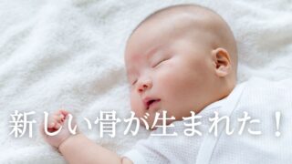 脛骨の骨切り日記 #19-新しい骨が出来てきた！